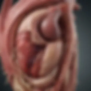 Magnificent Type 1 Aortic Dissection: Understanding a Critical Cardiovascular Condition Magnificent Type 1 Aortic Dissection: Understanding a Critical Cardiovascular Condition