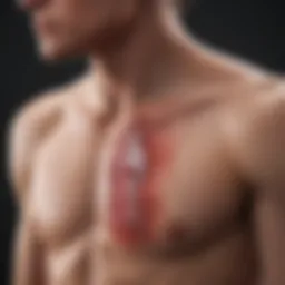 Diagram illustrating the pathophysiology of acute chest syndrome