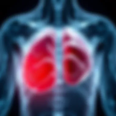 Stages of Multiple Myeloma Clinical representation of multiple myeloma stages