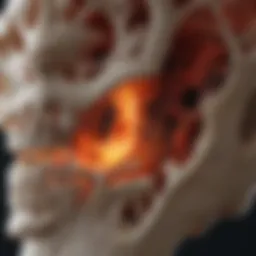 Radiological depiction of bone lesions in multiple myeloma