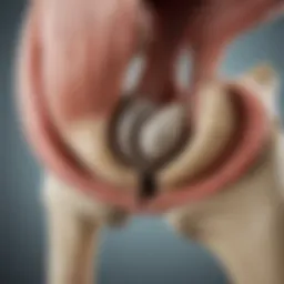 Illustration of the hip joint anatomy