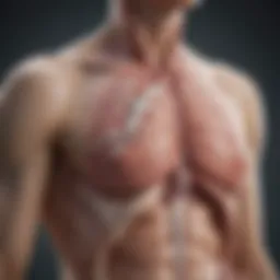Diagram illustrating congenital diaphragmatic hernia anatomy