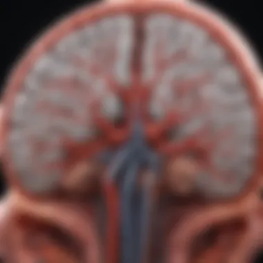 Cerebrovascular Disease Assessment CT scan highlighting cerebrovascular abnormalities
