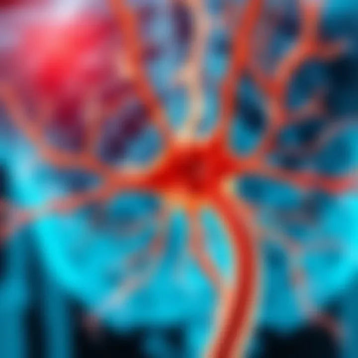 Diagram illustrating nerve damage mechanisms in paraprotein neuropathy