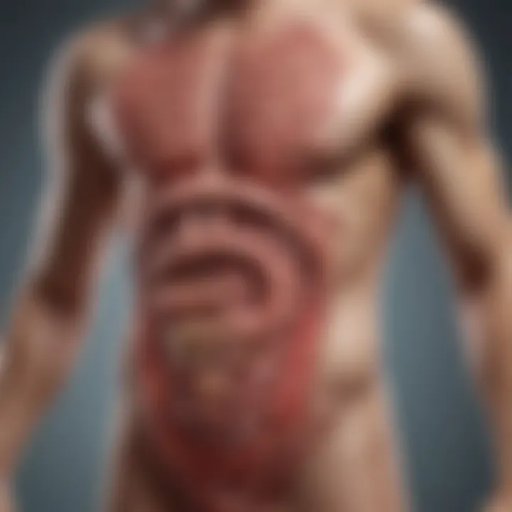 Diagram of various intestinal diseases