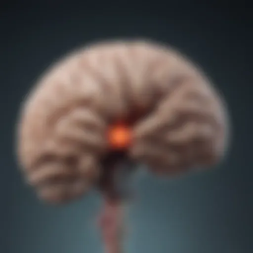 Illustration depicting the brain regions involved in hyperkinetic movement disorders