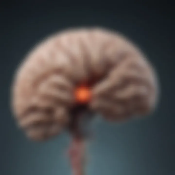 Illustration depicting the brain regions involved in hyperkinetic movement disorders