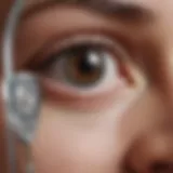 Close-up of an eye with a tonometer device