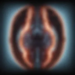High-resolution MRI scan illustrating rectal cancer staging