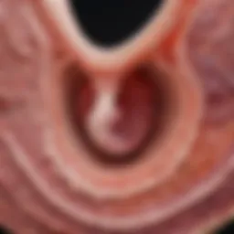 Detailed illustration of stage three uterine cancer pathology