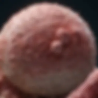 Infographic on diagnostic approaches for squamous cell carcinoma metastasis