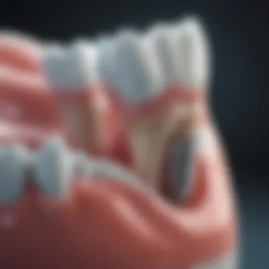 Tooth Enamel Remineralization Process Illustration of tooth enamel remineralization