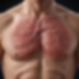 Pathophysiology of Acute Exacerbation of Idiopathic Pulmonary Fibrosis