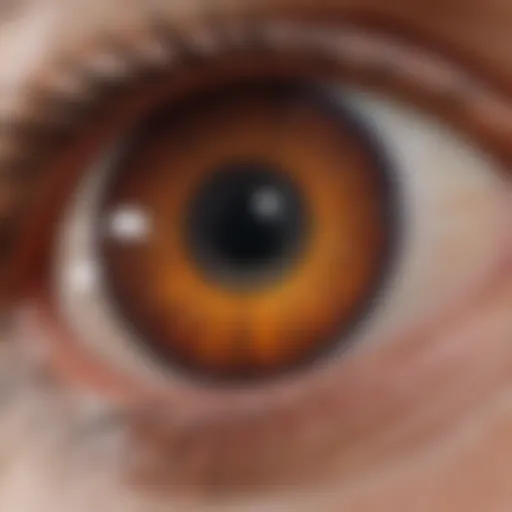 Illustration depicting the retinal layer affected by drusen accumulation.