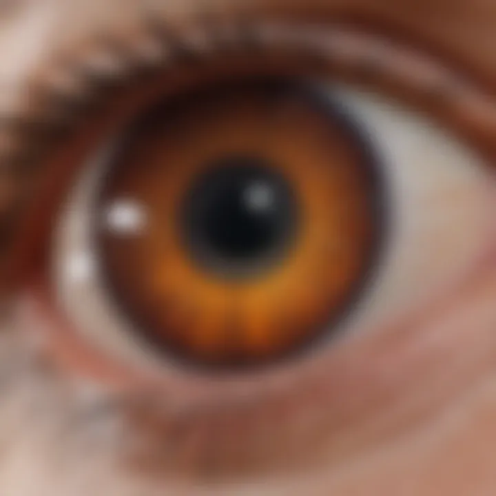 Illustration depicting the retinal layer affected by drusen accumulation.