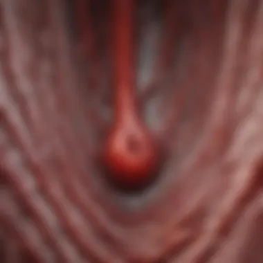Blood Vessel Narrowing Illustration of blood vessel narrowing due to stenosis