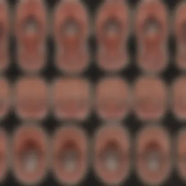 Imaging Techniques for Stenosis Assessment Diagram showing various imaging techniques for assessing stenosis