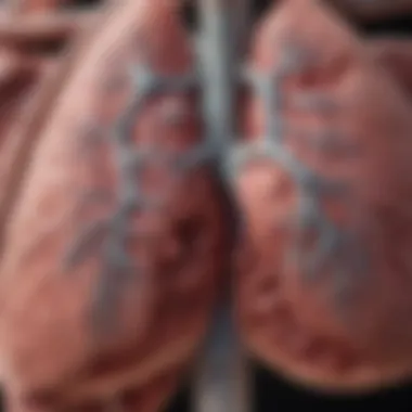 Illustration of the lungs affected by SCLC